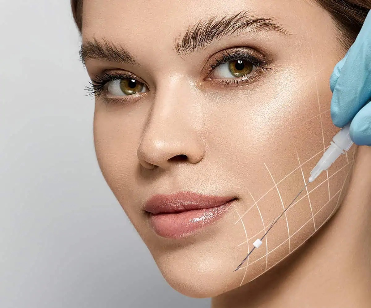PDO smoothing thread lifting treatment